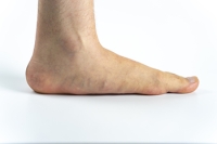 Advantages and Disadvantages of Having Flat Feet